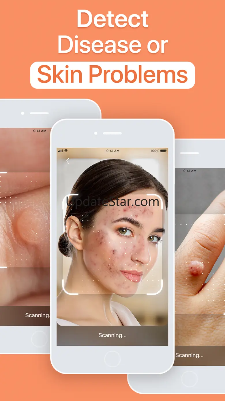 AI Skin Scanner－Scan & Analyze 1.0.7