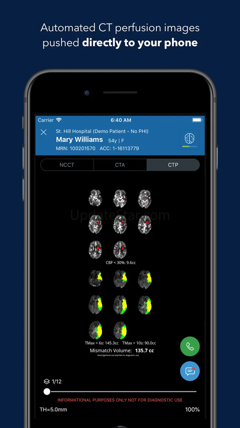 Viz Training AI Stroke Care 3.1.0