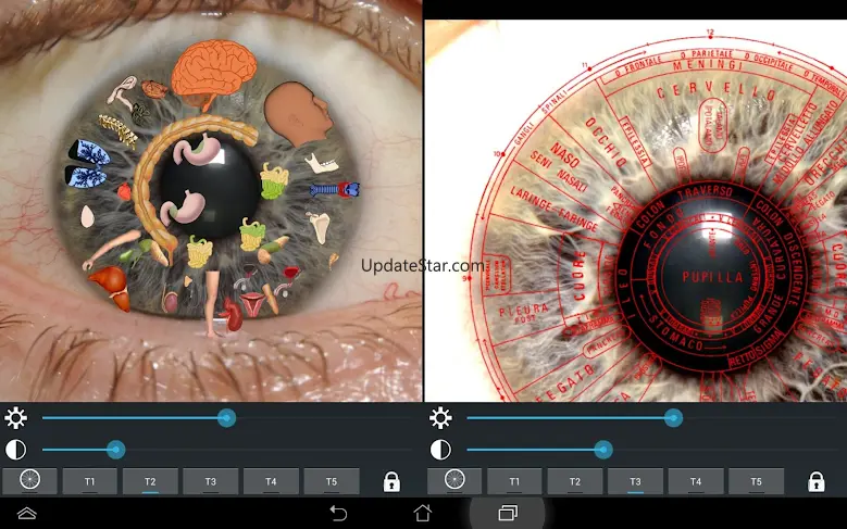 Eye Diagnosis 1.4.9