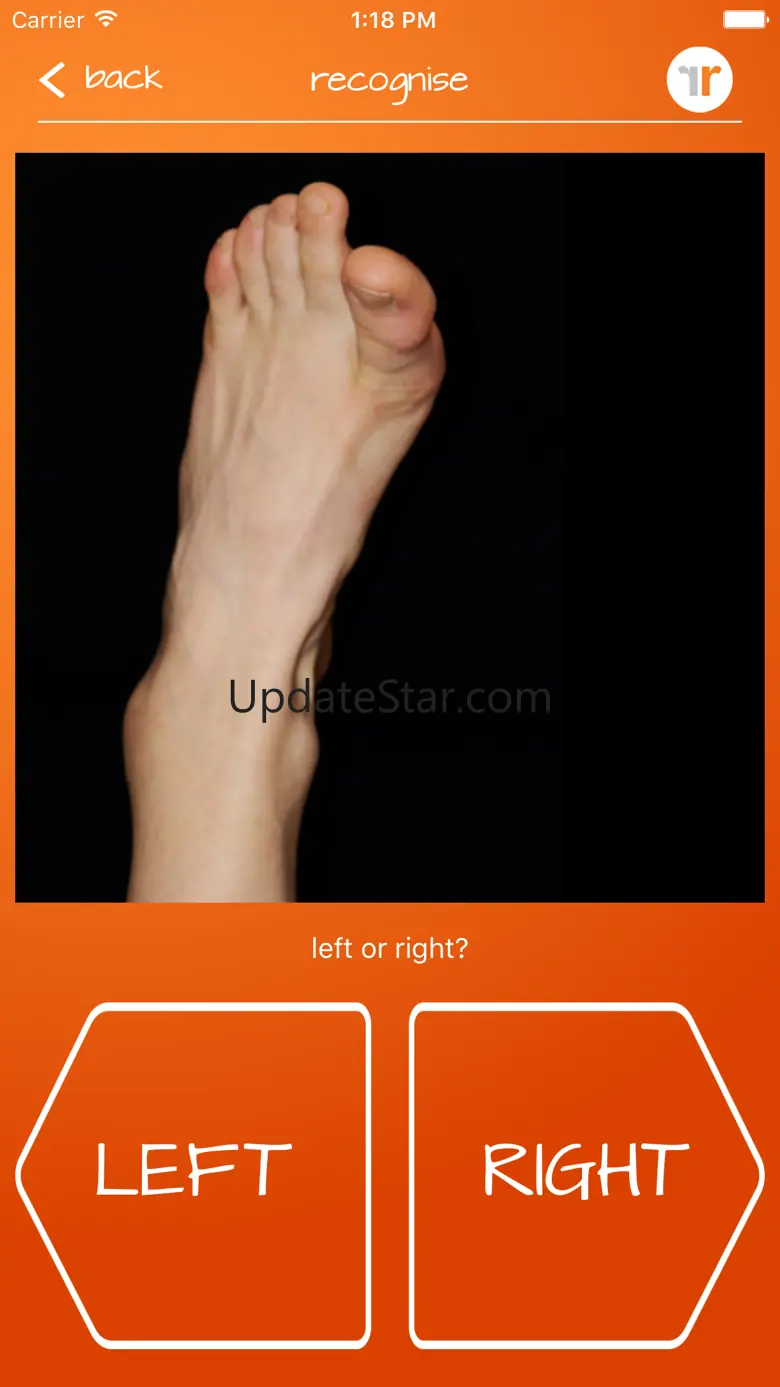 Recognise Foot 1.6