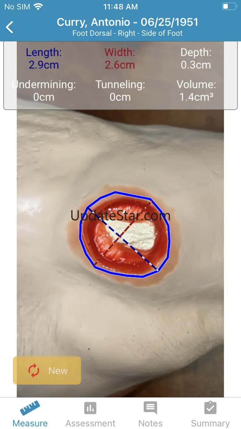 WoundZoom Mobile 1.3.5