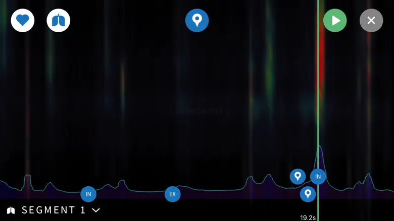 Steth IO 1.4.20