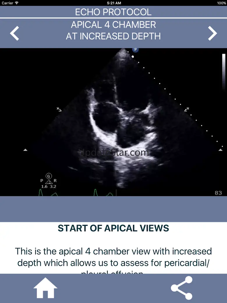LEARN FULL ECHO TTE PROTOCOL 20.0.0