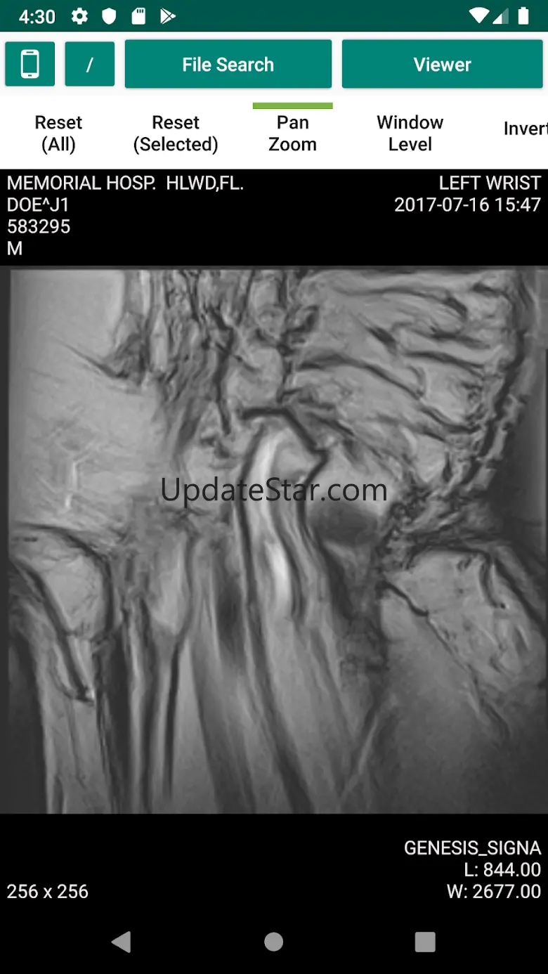 Dicom File Viewer 1.0.24