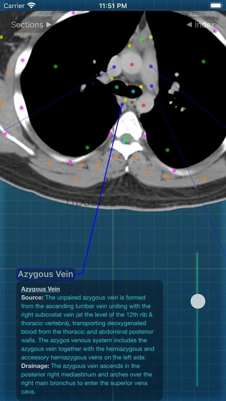 X-Anatomy Pro 3.3.0