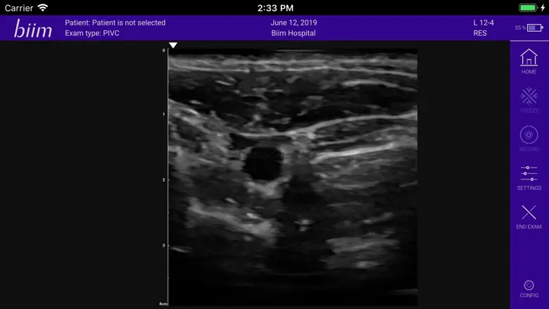 Biim Ultrasound 2.0.4