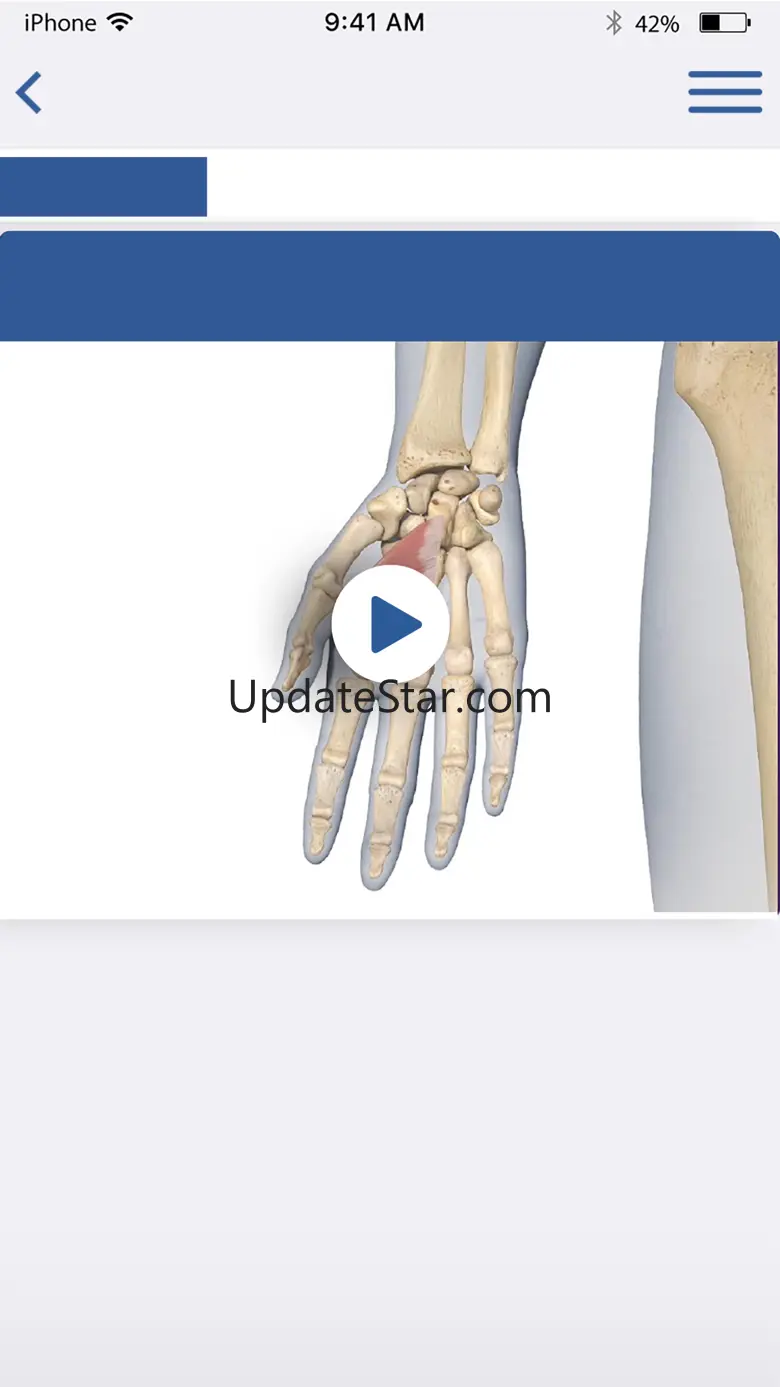 3D Spasticity 1.5