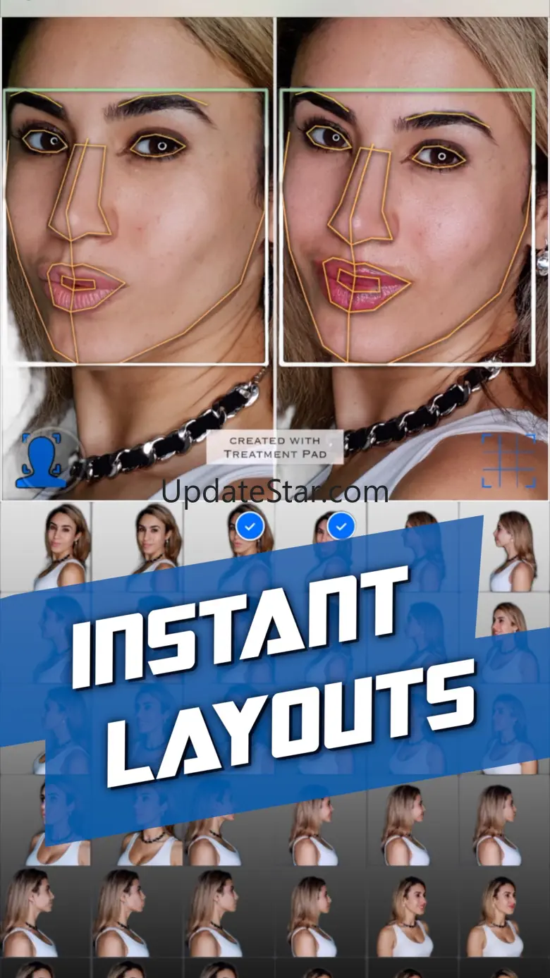 Treatment Pad - Layout Camera 1.7.4