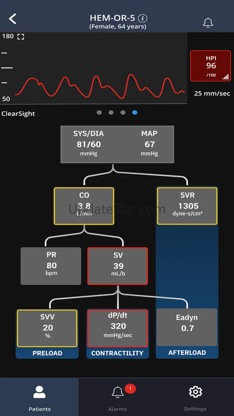 Viewfinder Remote 1.6.6