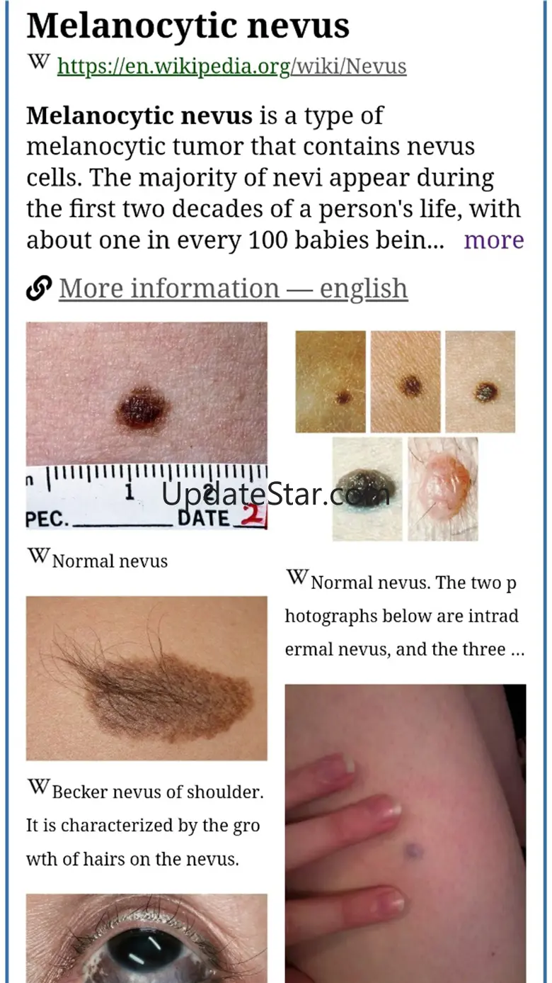 Model Dermatol - Wiki 14.2.51