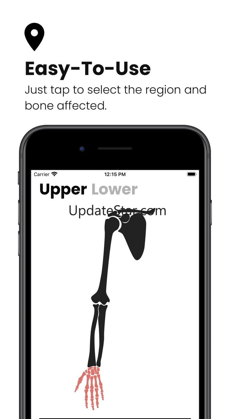 Fractures: Splinting App 1.0.3