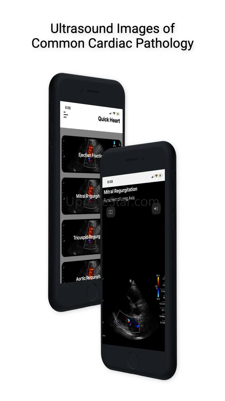 Fast Heart 1.3.5