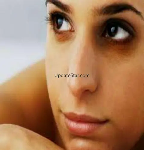 Dark Circles Tips 1.1