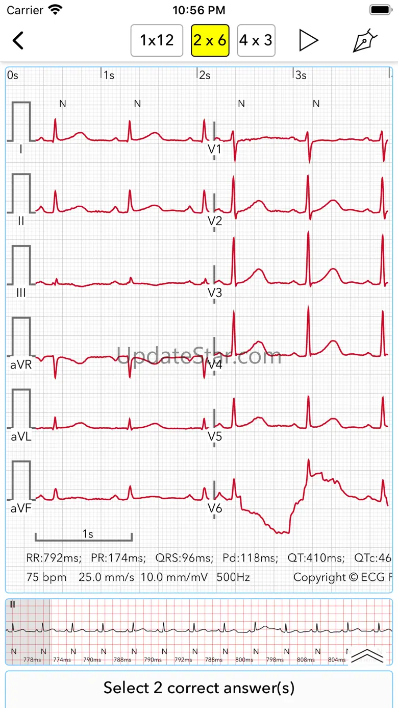ECG Test Pro for Doctors 2.1