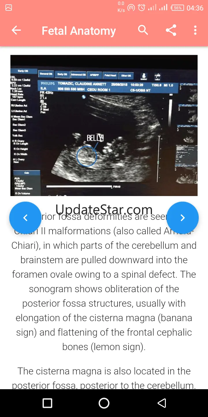 A-Z Obstetrics Ultrasound Guid 3.0