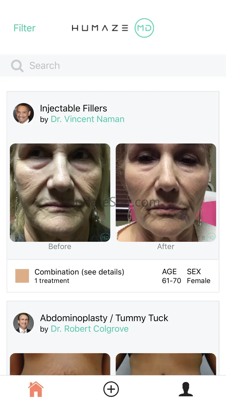 HumazeMD 2.1