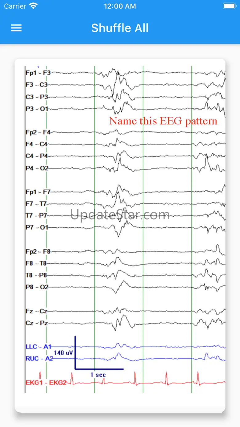 EEG Tutorial 1.0.4
