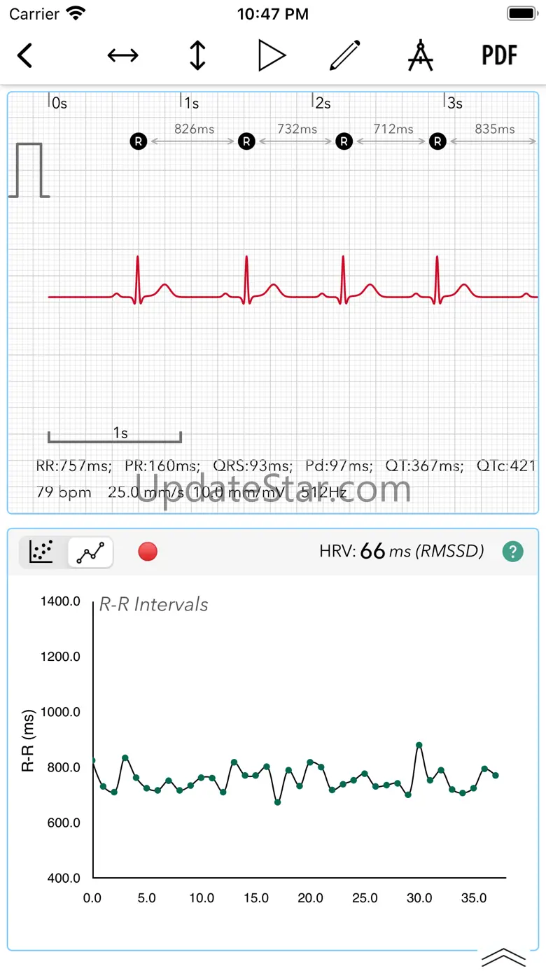 ECG+ | Analyzer for QTc & HRV 1.8.3