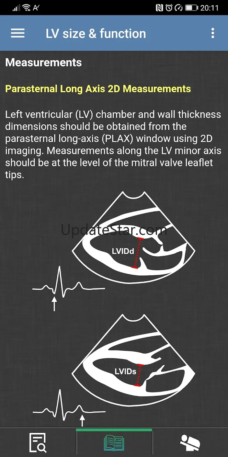 EchoCalc