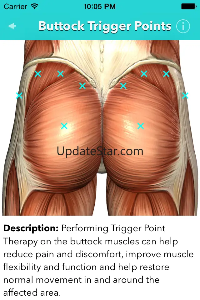 My Trigger Points 1.0