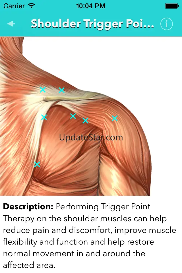 My Trigger Points 1.0