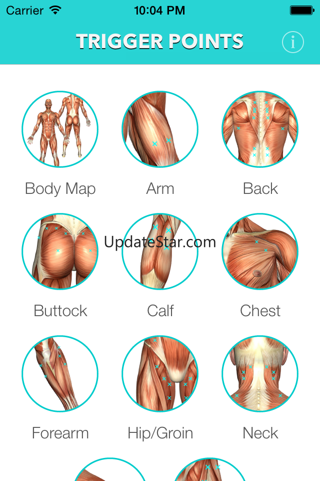 My Trigger Points 1.0