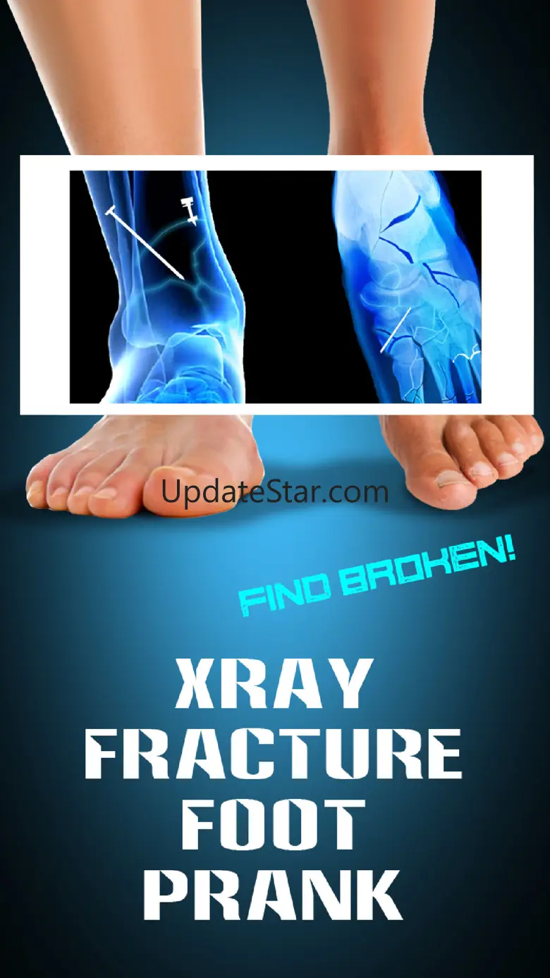 Xray Fracture Foot Prank 1.0