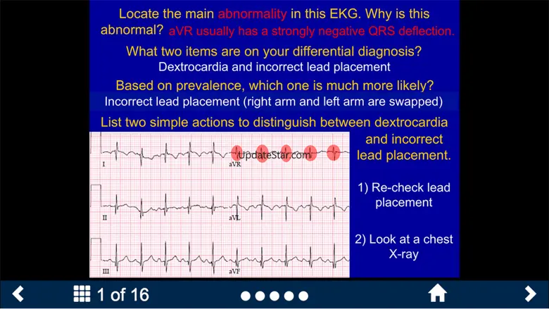 EKG - SecondLook 1.0