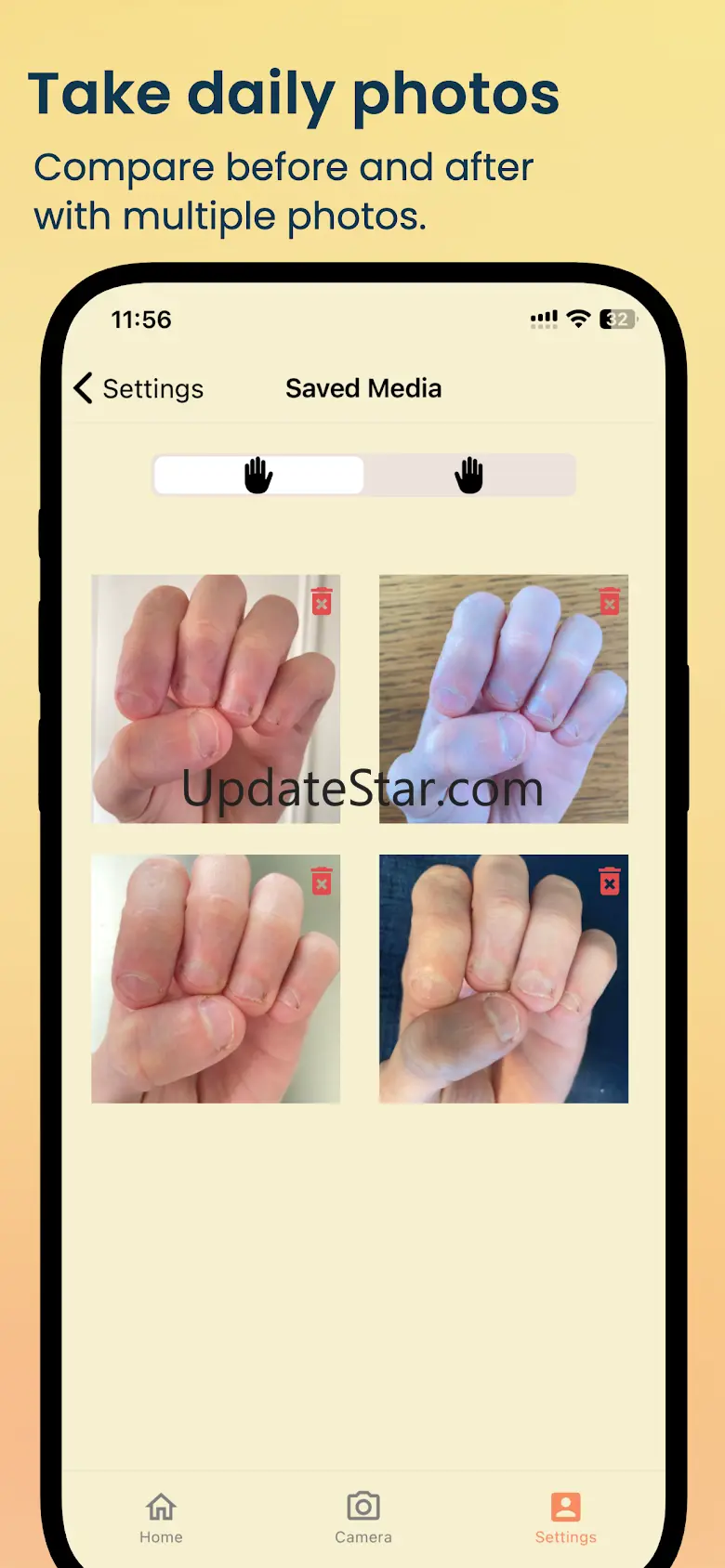 NailKeeper - Stop Biting Nails 2.4.5