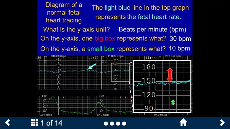 Fetal Heart Rate - SecondLook 1.0.0