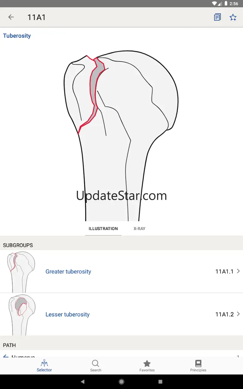 AO/OTA Fracture Classification 2.4.2